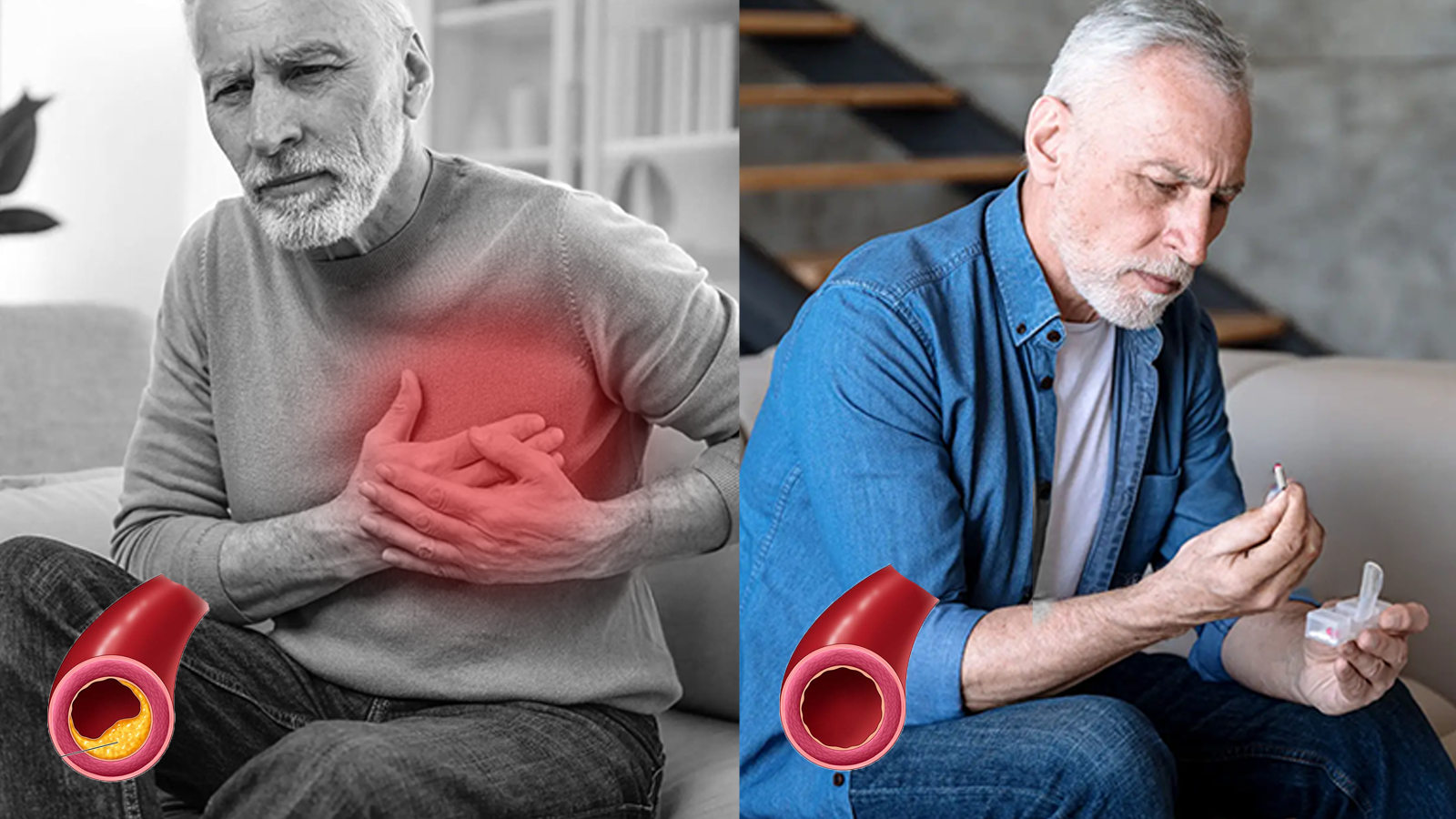 The Silent Killer in Your Arteries: How I Fought Back Against the Hidden Threat of Arterial Plaque